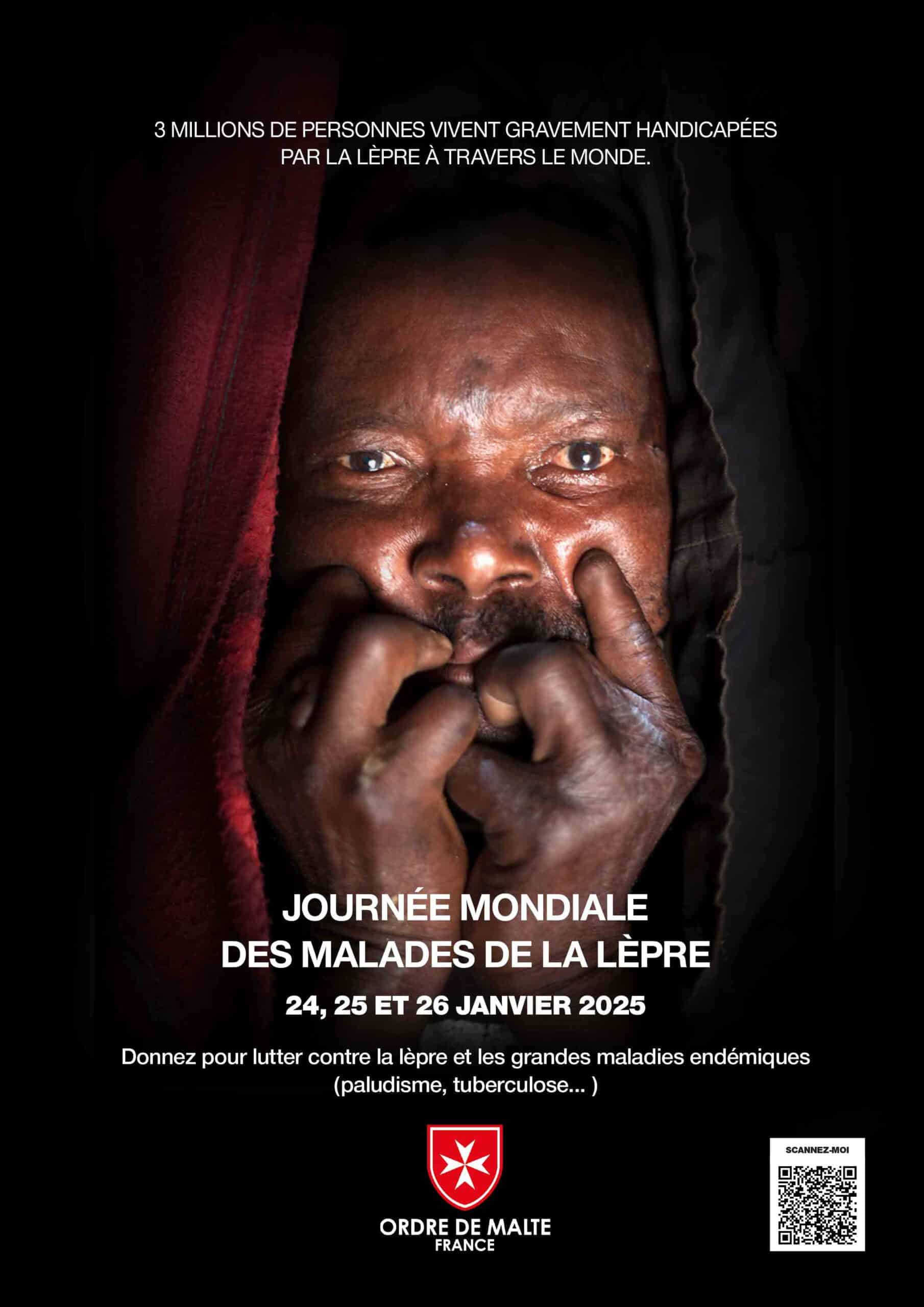 Journée Mondiale des Malades de la Lèpre 2025